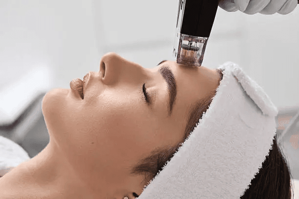 Microneedling treatment